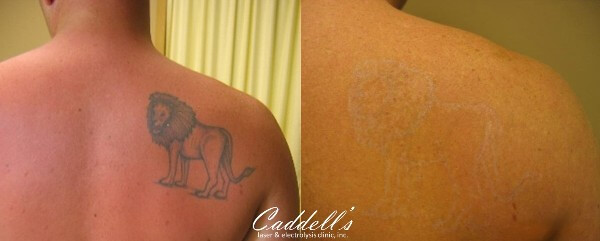 Lion Before and After