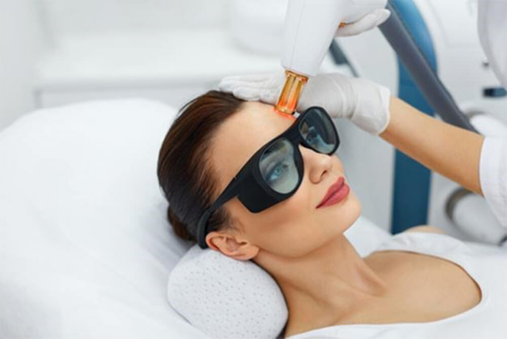 Caddell's laser-Lumenis